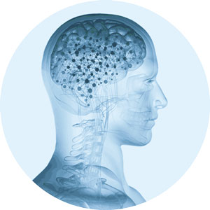 Neurochirurgie 1 Neurochirurgie Innsbruck Dr. Claudia Unterhofer